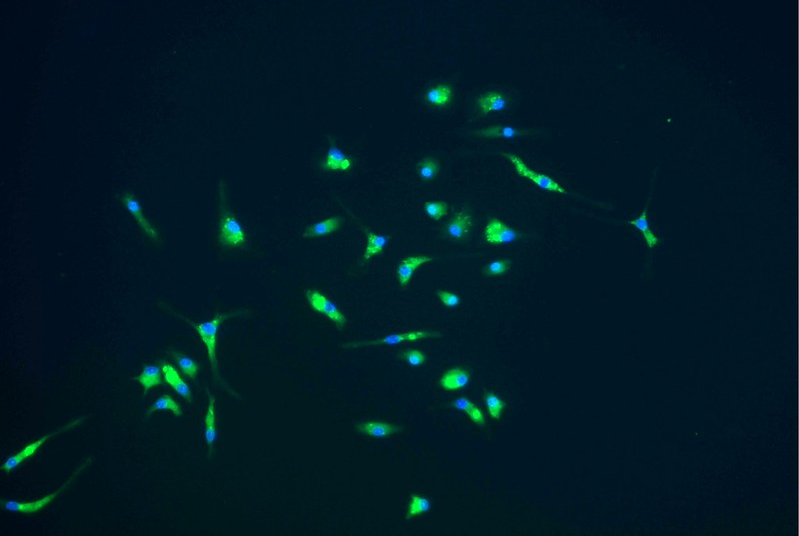 뇌 면역세포가 분비하는 단백질과 뇌 노화. 이미지: Weill Cornell Medicine
